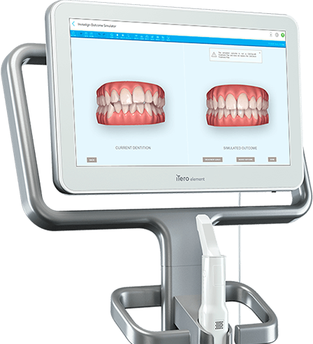 iTero 3D Scanner