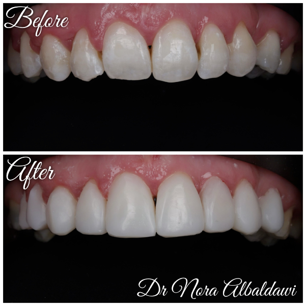 Face Image -Beautiful Smiles Dental