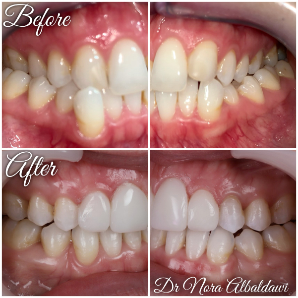 Face Image -Beautiful Smiles Dental