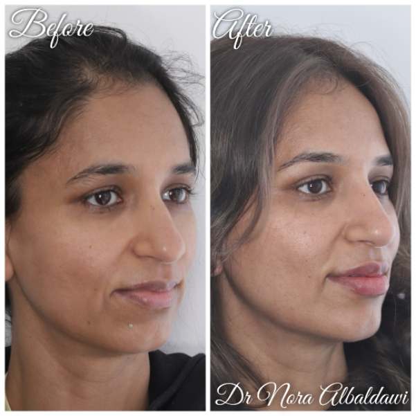 Face Image -Beautiful Smiles Dental