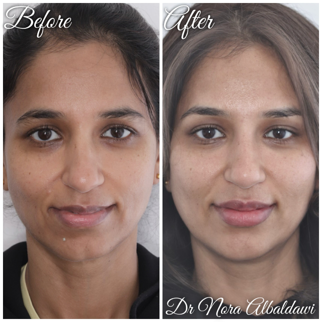 Gallery - Beautiful Smiles Dental