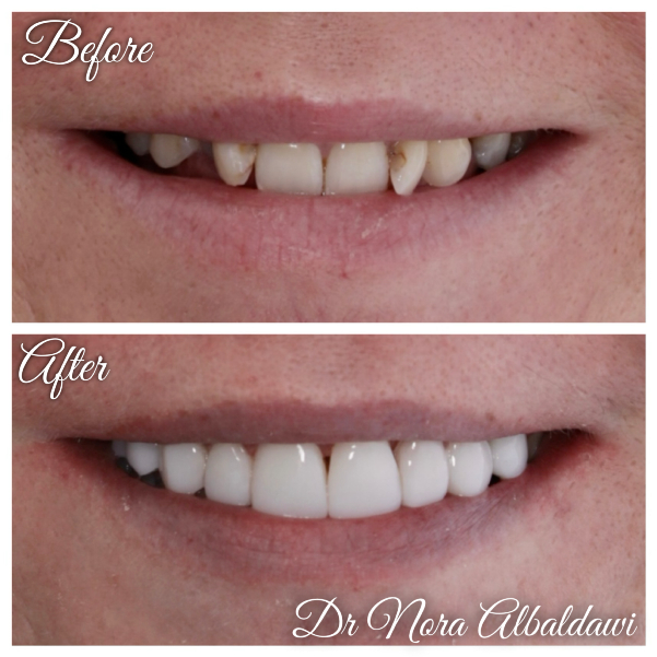Face Image -Beautiful Smiles Dental