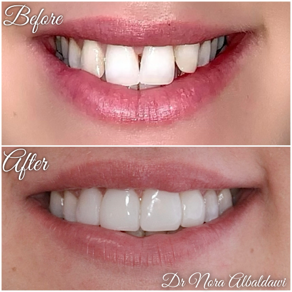 Face Image -Beautiful Smiles Dental
