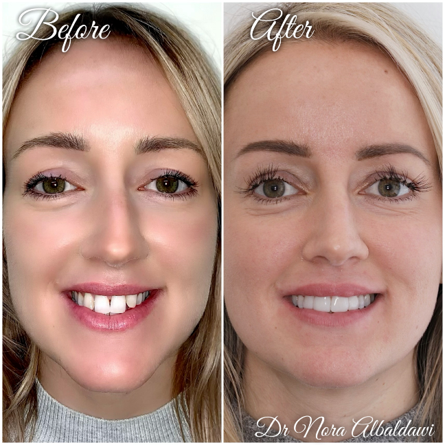 Gallery - Beautiful Smiles Dental