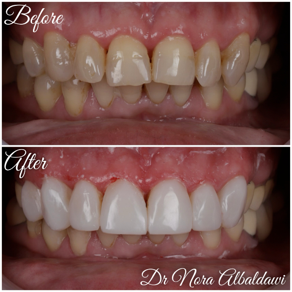 Face Image -Beautiful Smiles Dental