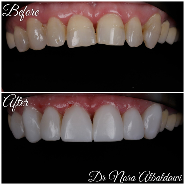 Face Image -Beautiful Smiles Dental