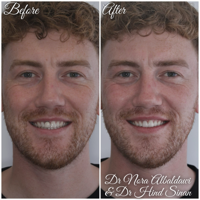 Gallery - Beautiful Smiles Dental