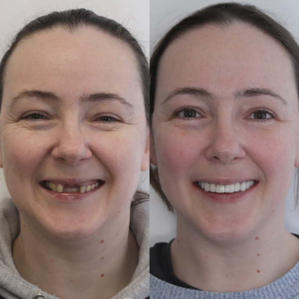 Face Image -Beautiful Smiles Dental
