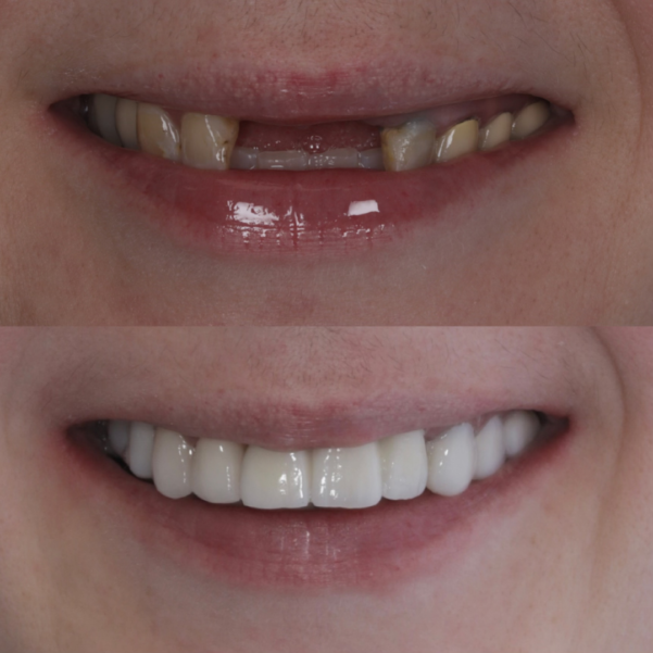 Teeth Image -Beautiful Smiles Dental